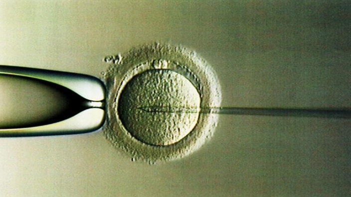 Intra-Cytoplasmatische Sperma-Injektion (ICSI), bei der die Spermien des Mannes im Labor direkt in eine der Frau entnommenen Eizelle injiziert werden. | Bildquelle: dpa/ Thomas Lohnes Intra-Cytoplasmatische Sperma-Injektion (ICSI), bei der die Spermien des Mannes im Labor direkt in eine der Frau entnommenen Eizelle injiziert werden.