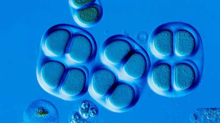 Mikroaufnahme von Cyanobakterien | Bildquelle: picture-alliance / OKAPIA KG, Germany / Norbert Lange Mikroaufnahme von Cyanobakterien
